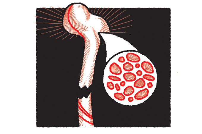 Dormir pouco pode aumentar risco de osteoporose e fraturas