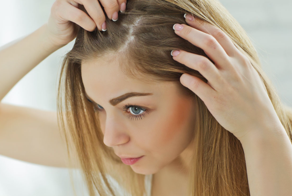 Calvície feminina: 9 dúvidas respondidas por especialista