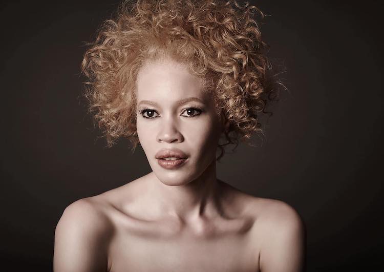 diandra-forrest-albino-model-9