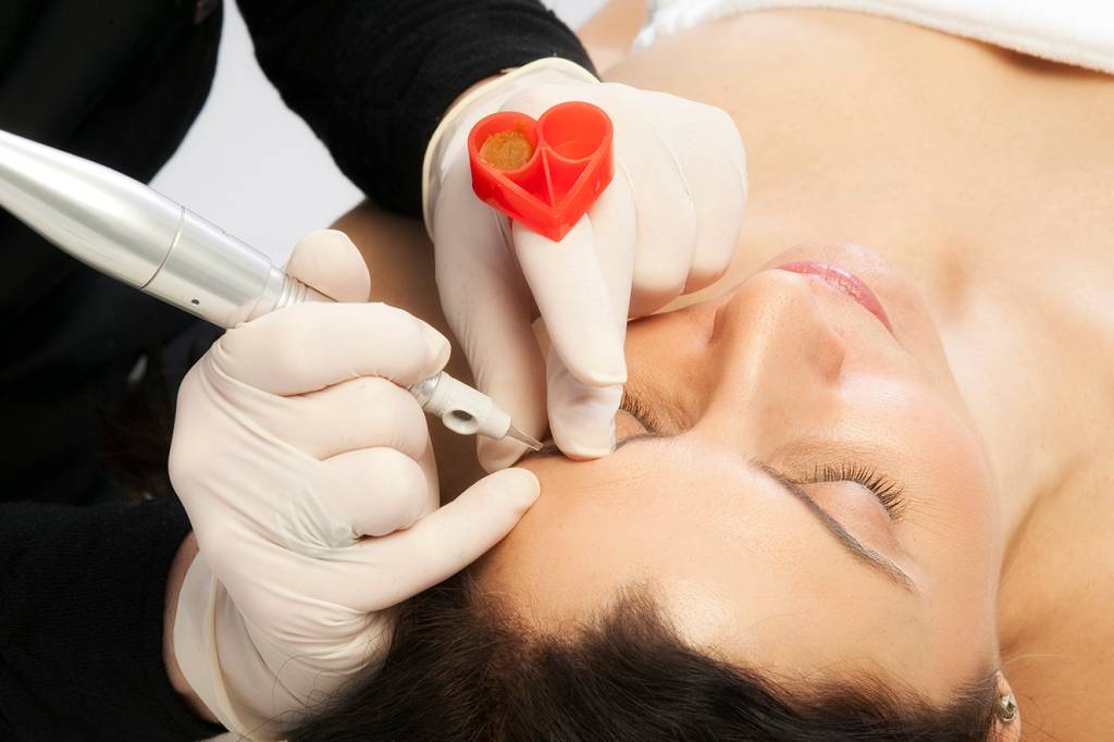 Despigmentação é a solução para sobrancelhas mal feitas