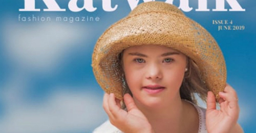 Modelo brasileira de 15 anos com Down vira capa de revista na Austrália
