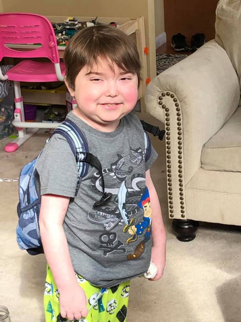 Menino tem doença rara Menino tem doença rara