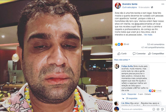 evandro santo agressão evandro santo agressão