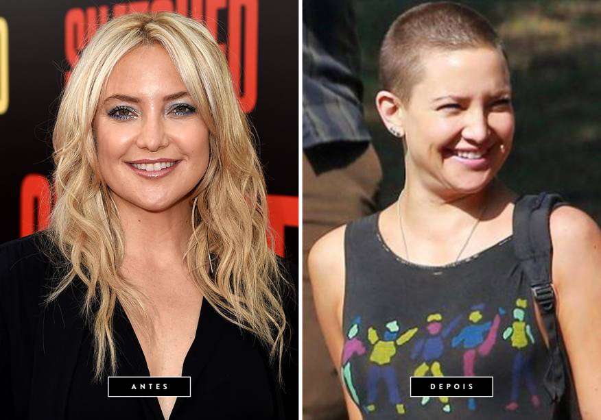 <strong>Agosto de 2017 // Kate Hudson</strong> - a atriz, que tinha como marca registrada seus fios loiros, assim como sua mãe, Goldie Hawn, raspou a cabeça para um projeto musical secreto dirigido pela cantora Sia. Há algum tempo, Hudson postou uma foto com <span>Maddie Ziegler, dançarina musa da cantora, o que nos deixou ainda mais curiosas!</span> <strong>Agosto de 2017 // Kate Hudson</strong> - a atriz, que tinha como marca registrada seus fios loiros, assim como sua mãe, Goldie Hawn, raspou a cabeça para um projeto musical secreto dirigido pela cantora Sia. Há algum tempo, Hudson postou uma foto com <span>Maddie Ziegler, dançarina musa da cantora, o que nos deixou ainda mais curiosas!</span>