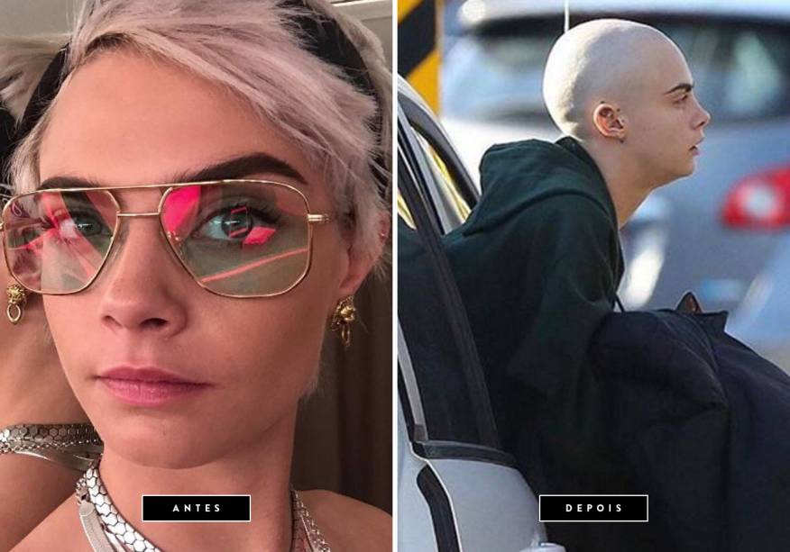 <strong>Abril de 2017 // Cara Delevingne</strong> - Pouco tempo depois de encarar o visual platinado, a modelo e atriz radicalizou mais uma vez. A britânica raspou completamente os cabelos para o filme <em>Life In a Year</em>, com estreia prevista para 2018. Na produção, Cara dará vida a uma adolescente em estado terminal. <strong>Abril de 2017 // Cara Delevingne</strong> - Pouco tempo depois de encarar o visual platinado, a modelo e atriz radicalizou mais uma vez. A britânica raspou completamente os cabelos para o filme <em>Life In a Year</em>, com estreia prevista para 2018. Na produção, Cara dará vida a uma adolescente em estado terminal.
