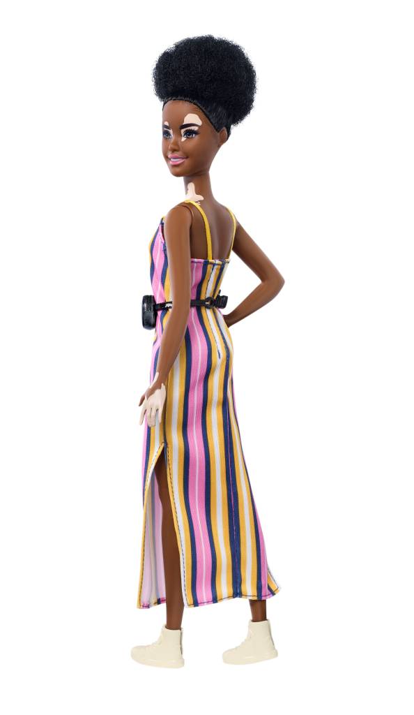 Barbie com vitiligo Barbie com vitiligo