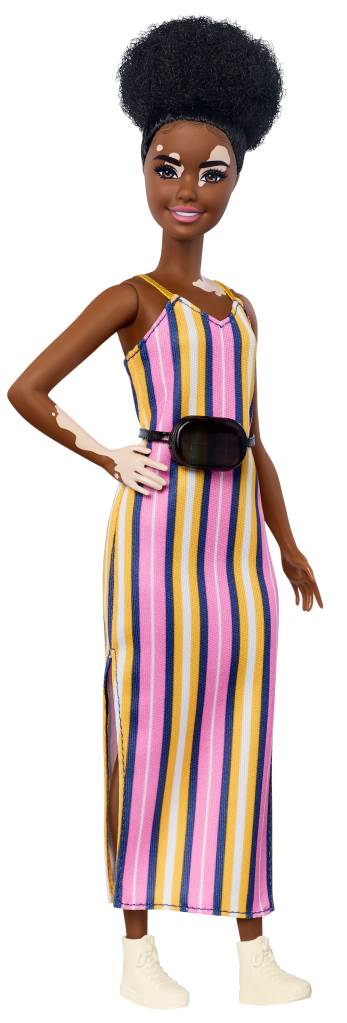 Barbie com vitiligo Barbie com vitiligo