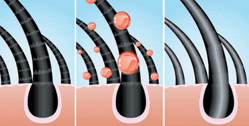 Botox capilar: o tratamento do momento Botox capilar: o tratamento do momento