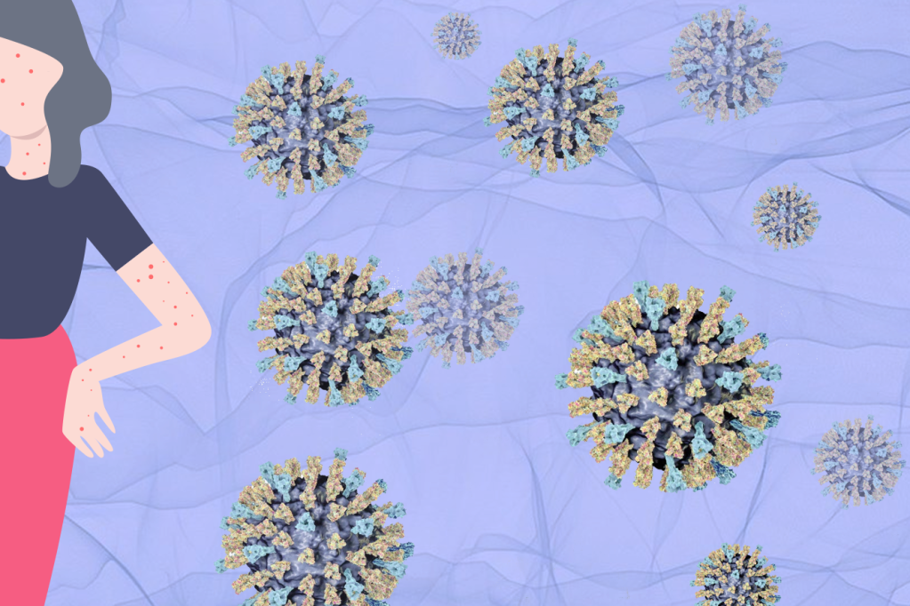 Mais grave do que se sabia, sarampo destrói a imunidade do corpo por anos