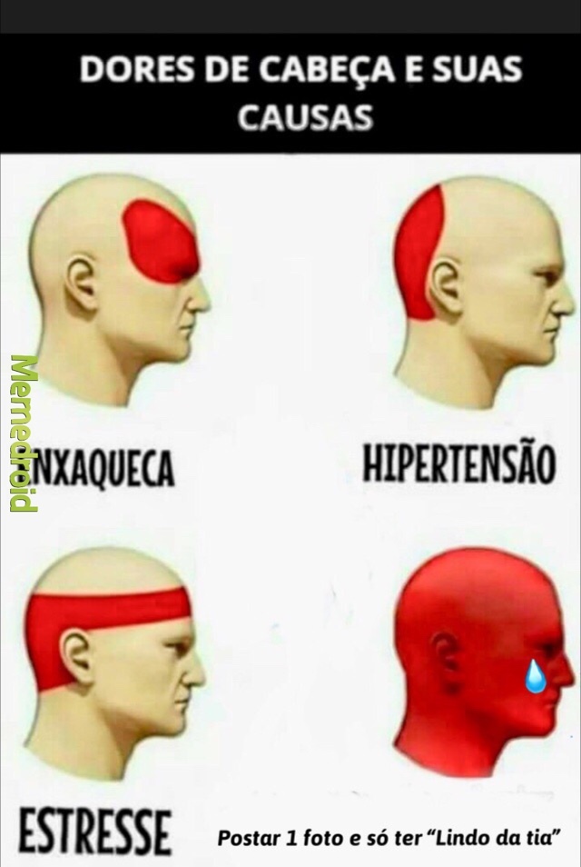 dor-de-cabec3a7a-meme-likes