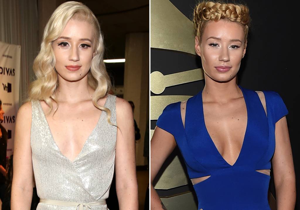 Iggy Azalea antes e depois do silicone