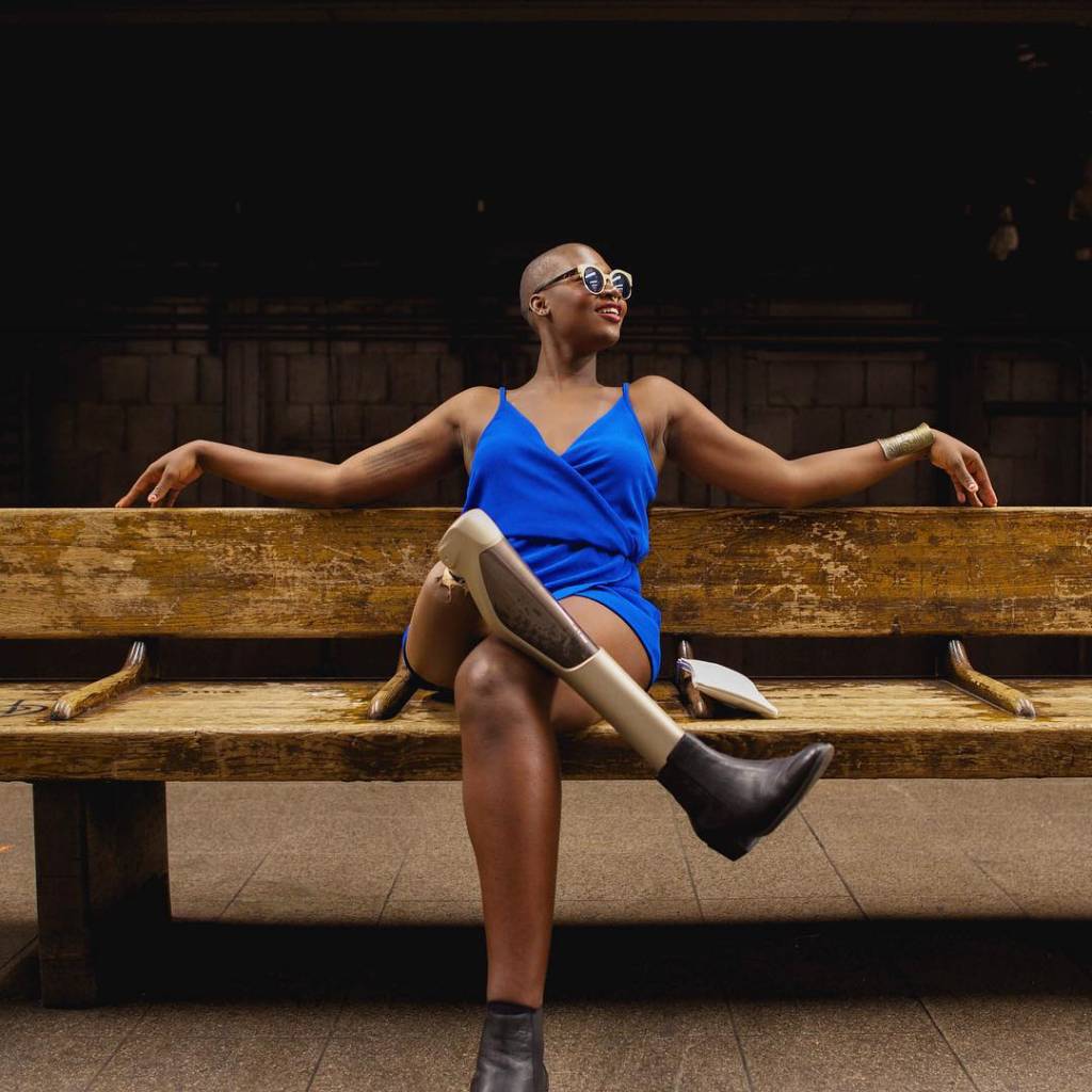 Essa blogueira amputada é pura inspiração de vida (e de moda!)