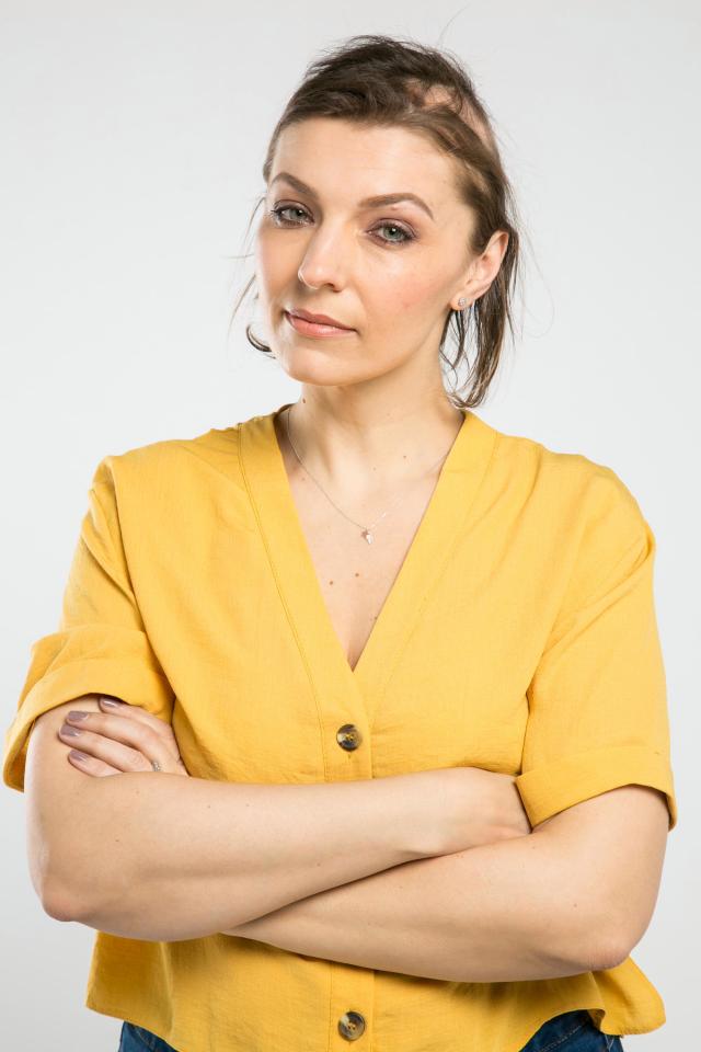 Noiva conta que perdeu quase todos os cabelos após se estressar com os preparativos do próprio casamento noiva-conta-que-ficou-careca-apos-planejar-o-casamento