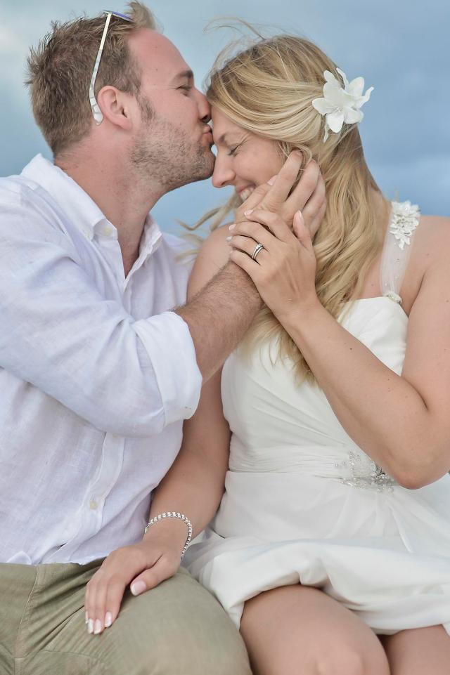 Noiva conta que perdeu quase todos os cabelos após se estressar com os preparativos do próprio casamento noiva-conta-que-ficou-careca-com-estresse-do-casamento-2