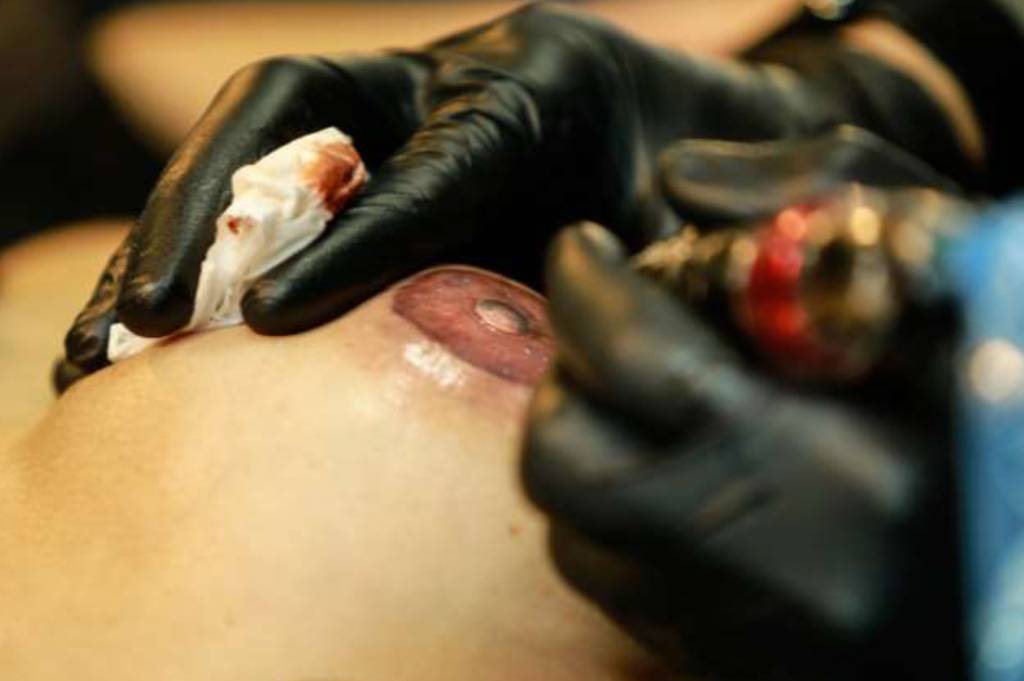 Reconstrução de aréola por tatuagem Reconstrução de aréola por tatuagem