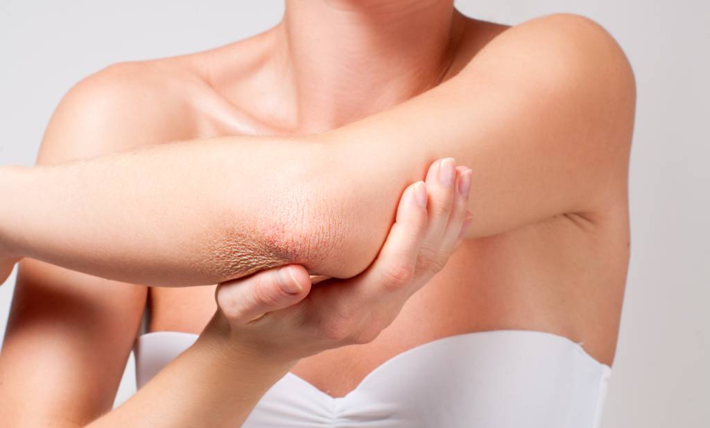 Cuidados com joelhos e cotovelos no frio Beauty and Body care. Female elbow.