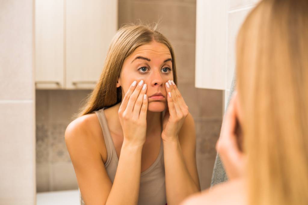Problemas de pele comuns Woman looking eye bags