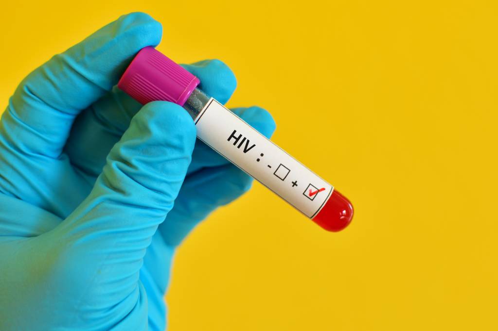 HIV positive HIV