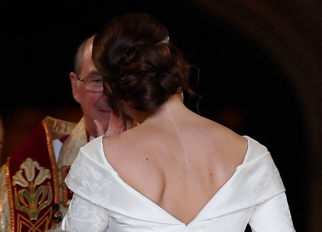 Princesa Eugenie Princesa Eugenie, no dia de seu casamento, com cicatriz de cirurgia de escoliose à mostra