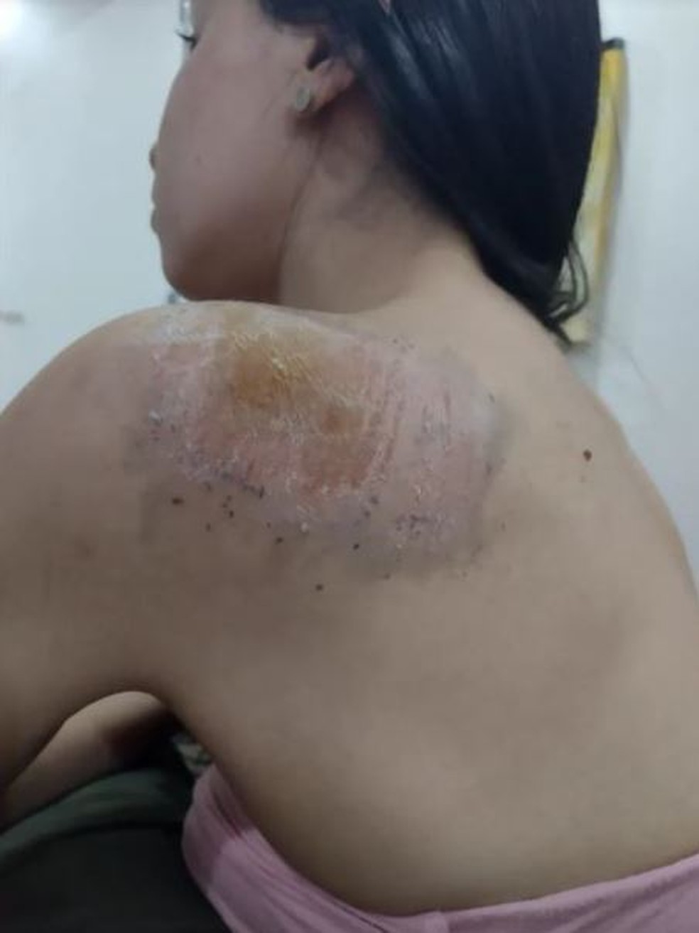 machucado ciclista assédio
