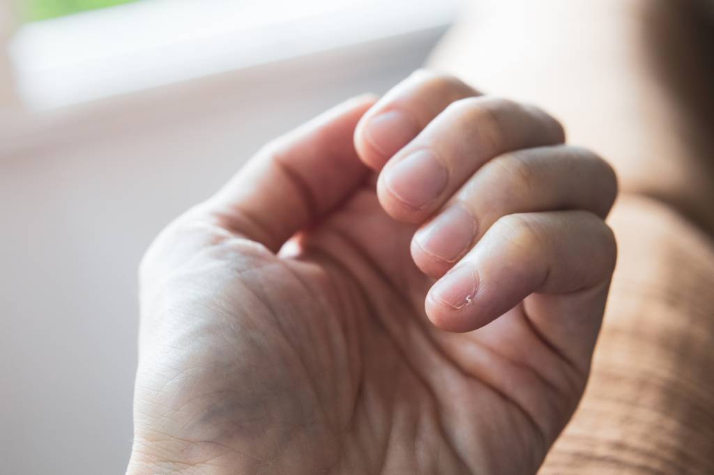 Hangnail on little finger Unha sem esmalte em fundo neutro