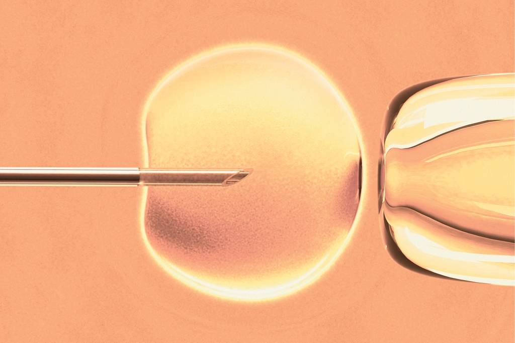 congelamento ovulos_ DENTRO DA MATERIA2 Para mulheres até os 35 anos, a taxa de sucesso do congelamento é de a taxa de sucesso é de 70% a 75%.