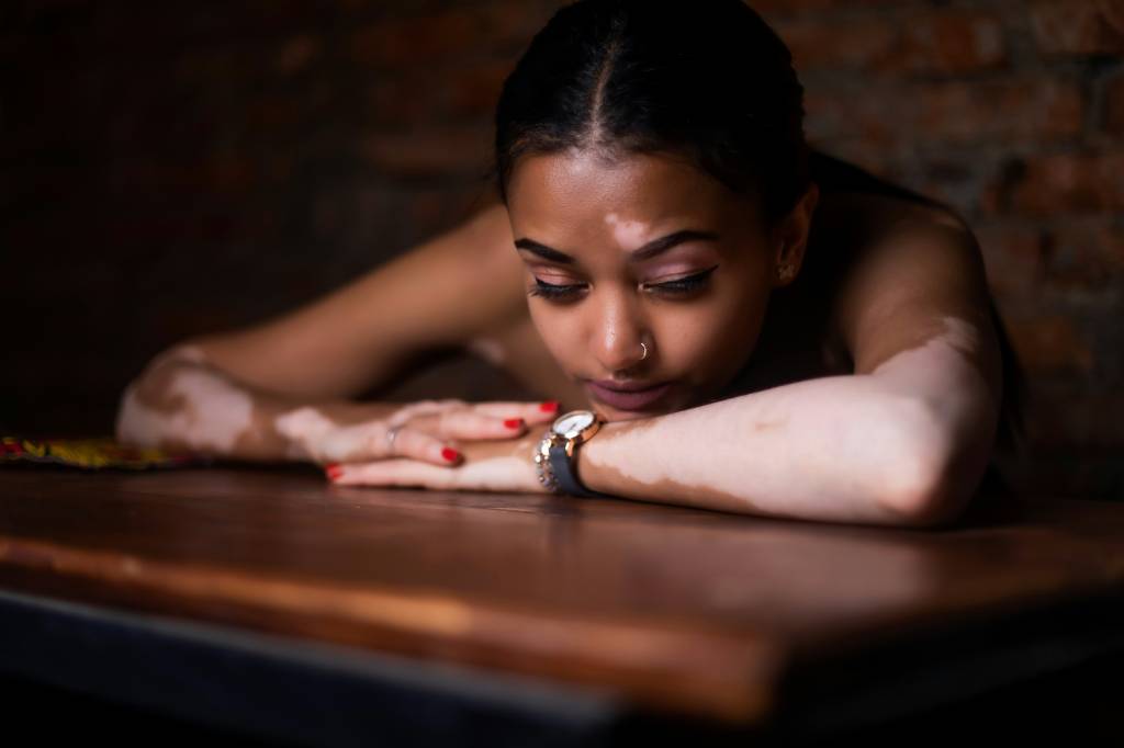 excesso-de-autoconsciência-2 O excesso tem uma reflexão profunda na forma como lidamos com nossos relacionamentos