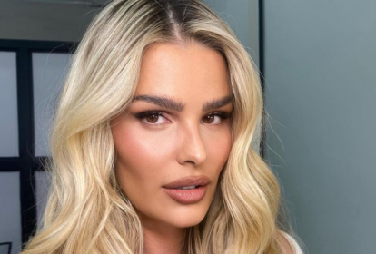 O que é lipedema, doença de Yasmin Brunet