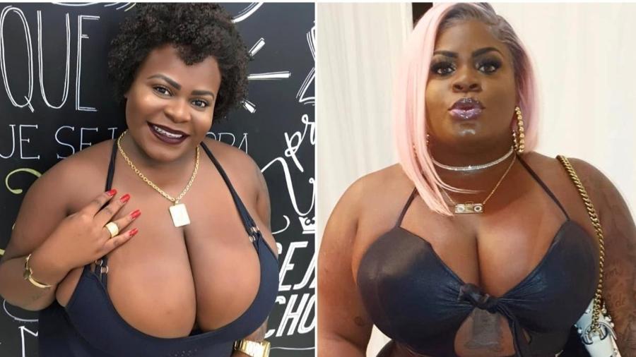 jojo-todynho-reducao-de-mama-antes-e-depois Jojo Todynho - cirurgia de redução de mamas