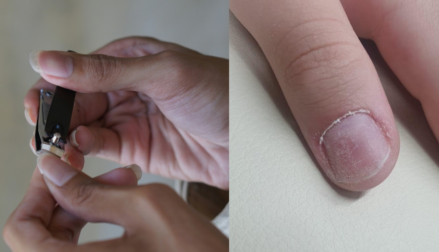 Como cuidar das cutículas em casa sem danificar as unhas?