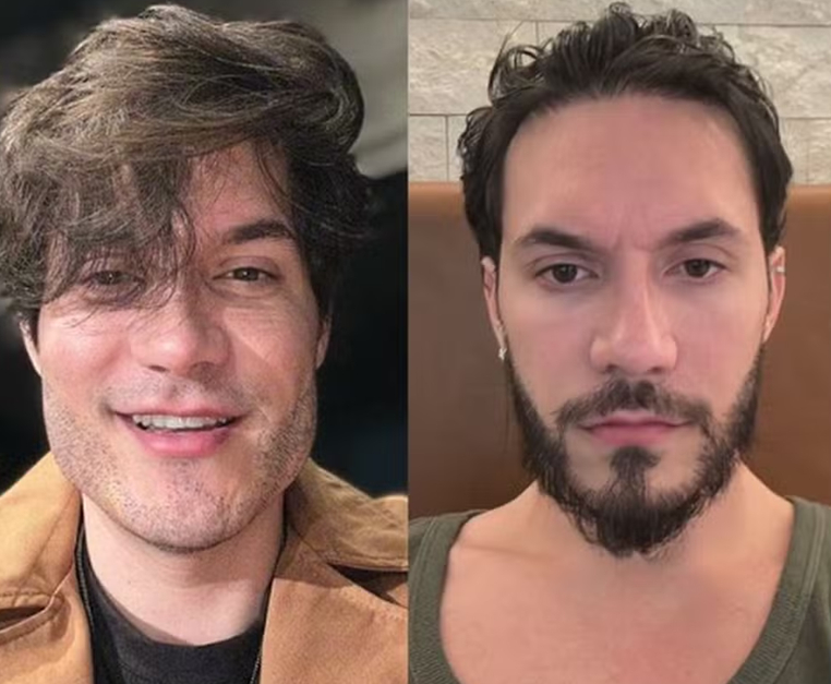 harmo-eliezer O ex-BBB Eliezer desfez a harmonização facial no ano passado