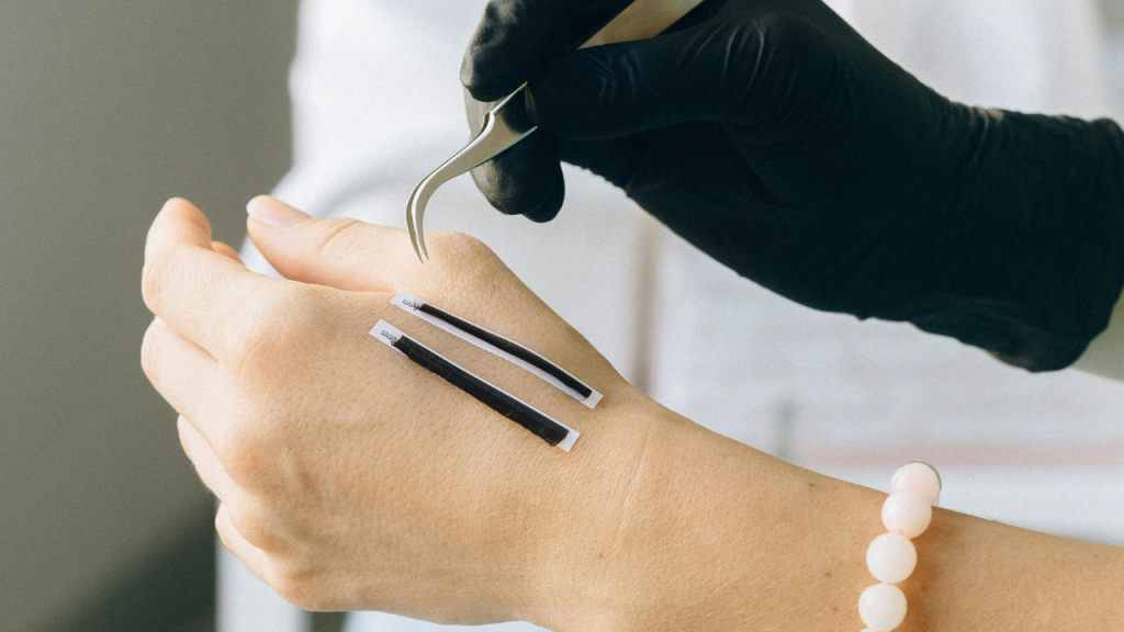 A harmonização das mãos pode envolver enxerto de gordura ou aplicação de ácido hialurônico