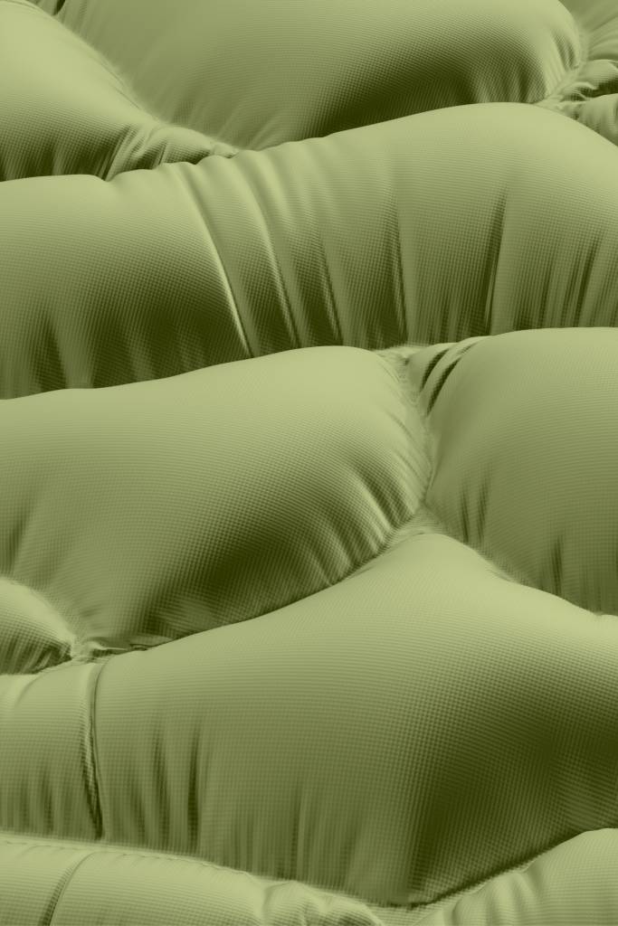 Caracterizado pelo acúmulo anormal de células adiposas em áreas específicas, como quadris, braços e pernas, o lipedema provoca um desajuste nas proporções corporais e pode causar sintomas incômodos